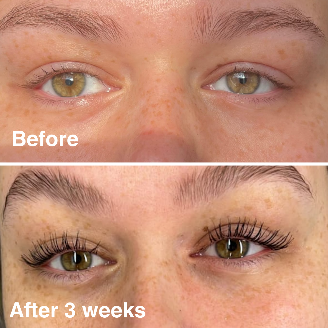 Eyelash Growth Serum